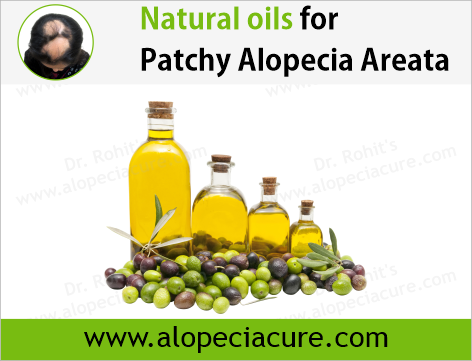 100% Natural Oils for Alopecia Areata
